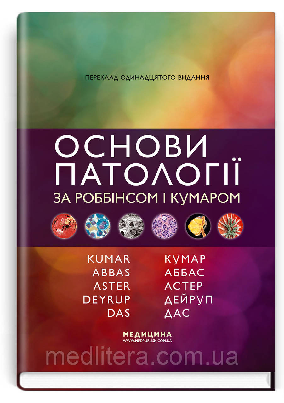 Основи патології за Роббінсом і Кумаром: 11-е видання / Віней Кумар, Абул К. Аббас, Джон К. Астер та ін.