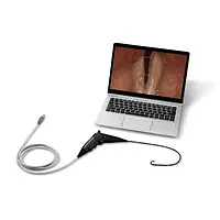 Гнучкий ларингоскоп Weseemed RP11A