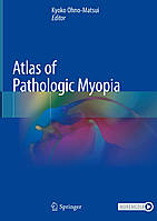 Atlas of Pathologic Myopia. 2020. Kyoko Ohno-Matsui.