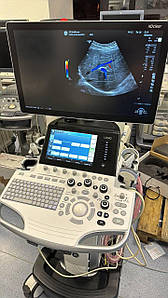 УЗД апарат експертного класу GE LOGIQ S7 з технологією XDclear 2.0