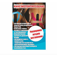 Плакат Vivay Кинезиотейпирование А1 (5448) BK, код: 6863127