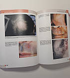 Хебіф Шкірні хвороби: діагностика та лікування 2021 рік Посібник атлас з дерматології, фото 9