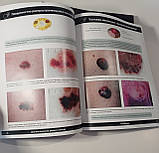 Боулінг Джонатан Діагностична дерматоскопія. Ілюстроване керівництво, фото 9