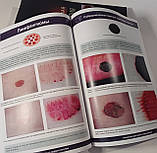 Боулінг Джонатан Діагностична дерматоскопія. Ілюстроване керівництво, фото 10