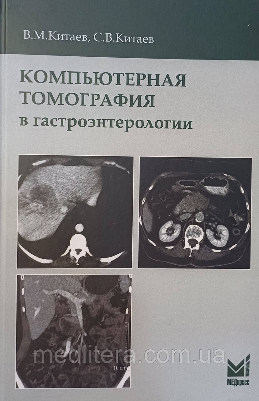 Китаєв В, Китаєв Комп'ютерна томографія в гастроентерології 2019 рік / КТ в гастроентерології
