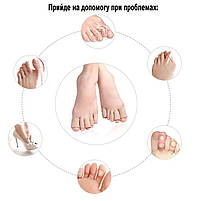 Напальчники силіконові обрізні від мозолів та натоптишів 1шт 2,5х15см. Захист від натирання на пальці, фото 5