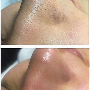 Ультразвуковий скрабер для очищення обличчя Ultrasonic Shovel Beauty Start, фото 4