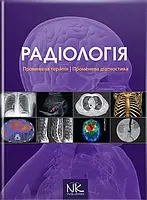 Радіологія. Променева терапія. Променева діагностика. — 2-ге вид. // Ковальський О. В. та ін.