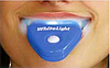 Засіб для відбілювання зубів White Light (Вайт Лайт) Комплект для відбілювання зубів у домашніх умовах., фото 6
