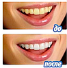 Засіб для відбілювання зубів White Light (Вайт Лайт) Комплект для відбілювання зубів у домашніх умовах., фото 4