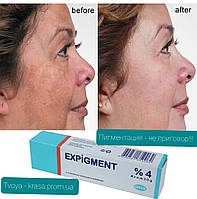 Expigment  4% крем ,Экспигмент 4%, Турция