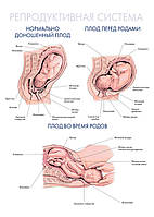 Репродуктивная система. Нормально доношенный плод. Плод перед родами. Плод во время родов - плакат
