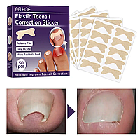 Набір пластирів для корекції та усунення врослих нігтів Elastic Toenail Correction Sticker 50 шт