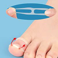 Силіконові кільця для корекції врослого нігтя Toe Nail Tool 2 штуки