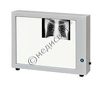 Негатоскоп Н-2 для перегляду знімків медичний