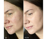 Професійний ліфтинг-кушон DEBEAUS FACE LIFT SPF50+/PA+++ для світлої шкіри з холодним підтоном, 15 г + 15 г (змінний блок) (ID#1887580059), ціна: 2190 ₴, купити на Prom.ua Професійний ліфтинг-кушон DEBEAUS FACE LIFT SPF50+/PA+++ для світлої шкіри з холодним підтоном, 15 г + 15 г (змінний блок) (ID#1887580059), ціна: 2190 ₴, купити на Prom.ua