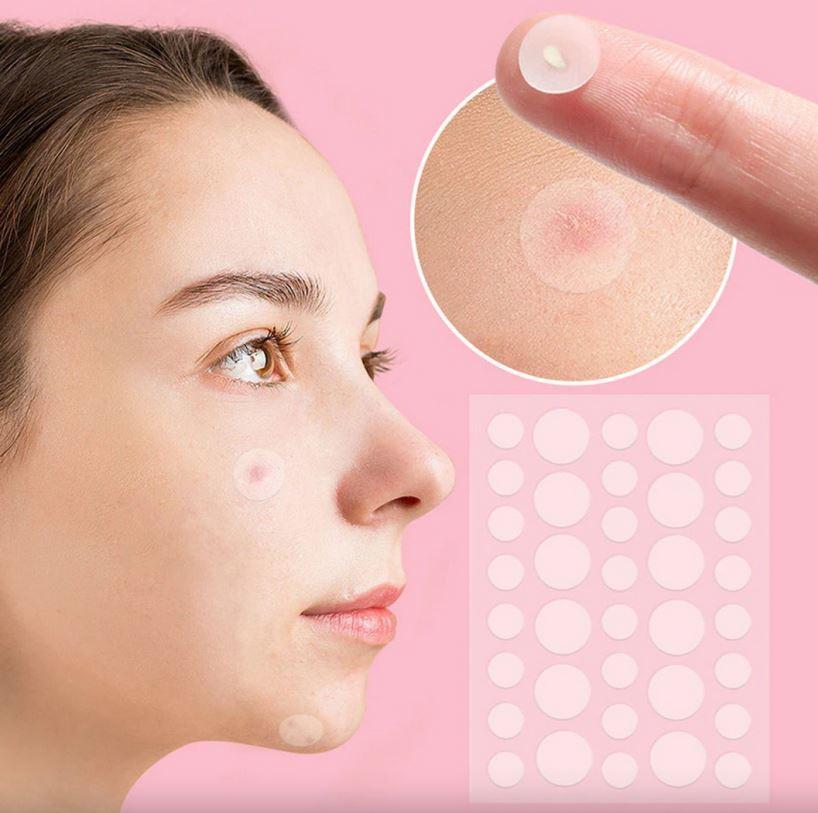 Патчи от прыщей и акне 72 шт Acne Patch / Пластырь косметический для лечения акне, фото 1
