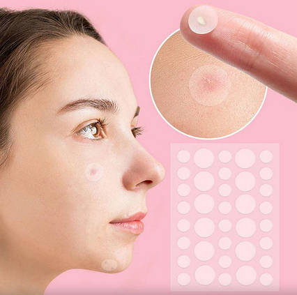 Патчи от прыщей и акне 72 шт Acne Patch / Пластырь косметический для лечения акне