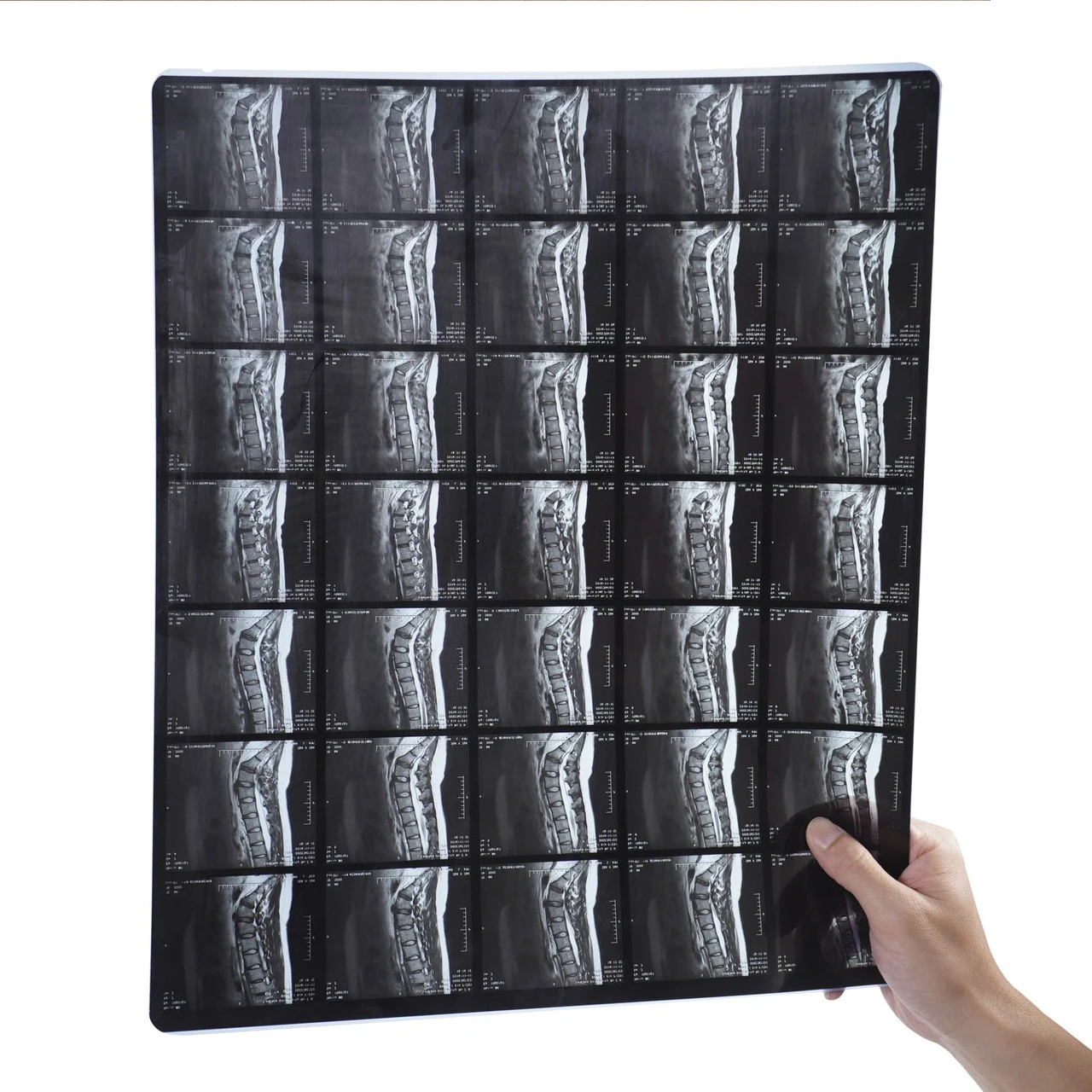 Пленка IMAX Medical Dry Imaging Film 8x10" No100 арк