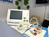 Sonicaid Team 3 фетальний монітор БВ як новий (близько 10-15 досліджень), фото 2
