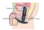 Телескопічна анальна пробочка з ерекційним кільцем, вібрацією та дистанційним керуванням, фото 4
