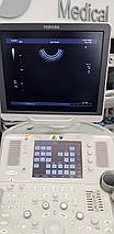 Апарат УЗІ Toshiba Aplio MX, фото 5