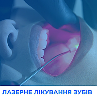 Чому стоматологам варто перейти на лазерне лікування зубів