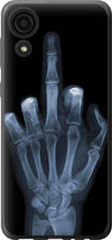 Чохол на Samsung Galaxy A03 Core A032F Рука через рентген "1007u-2539-851"
