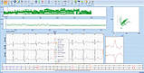 Холтер добового ЕКГ EUROHOLTER 3-х або 12и канальний з ПО, фото 7