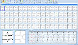 Холтер добового ЕКГ EUROHOLTER 3-х або 12и канальний з ПО, фото 9