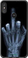 Силиконовый Чехол на Motorola One Power Рука через рентген , Украина (Made in Ukraine)