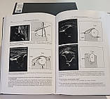 Викрэм Догра, Дебра Рубенс Секрети ультразвукової діагностики 2017 рік Секрети УЗІ, фото 2