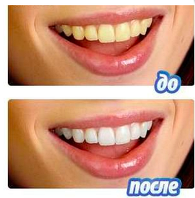 Засіб для відбілювання зубів White Light (Вайт Лайт) Комплект для відбілювання зубів у домашніх умовах.