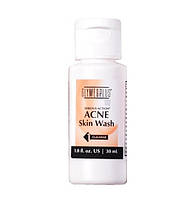 Serious Action Skin Wash Гель для умывания с 2.5 % бензоил пероксида, 30 мл