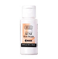 Serious Action Skin Wash Гель для вмивання з 2.5 % бензоїл пероксиду, 30 мл