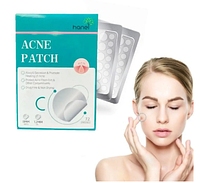 Пластырь от бородавок и прыщей Acne Patch 72 шт, средство для удаления папиллом и натоптышей dto