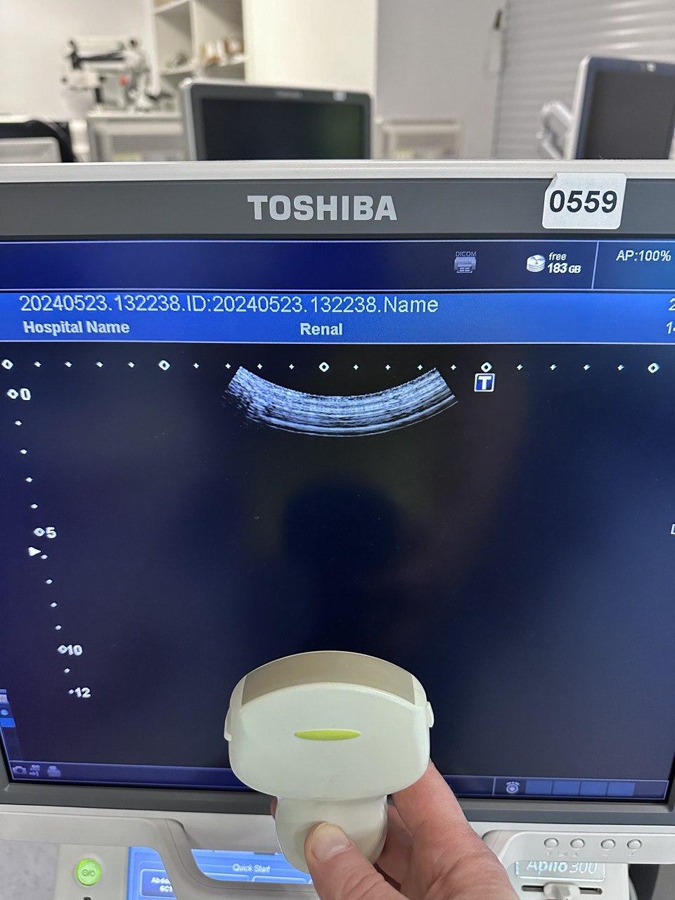 Конвексний ультразвуковий датчик Toshiba PVT-375BT