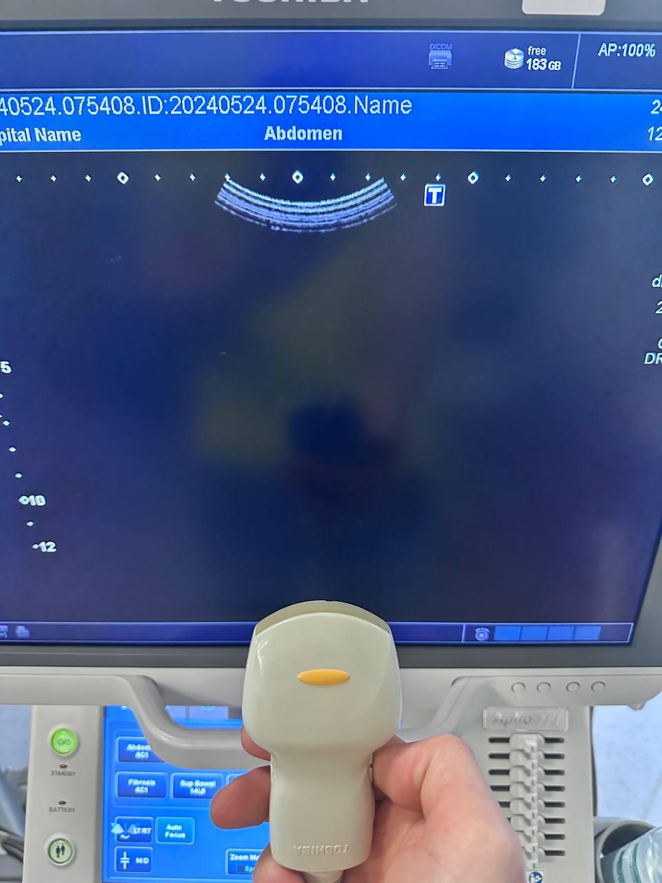 Конвексний ультразвуковий датчик Toshiba PVT-674BT