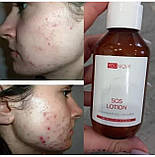 Тонік з АНА ВНА кислотами та рослинними екстрактами, Джерелія, 100 мл, фото 10