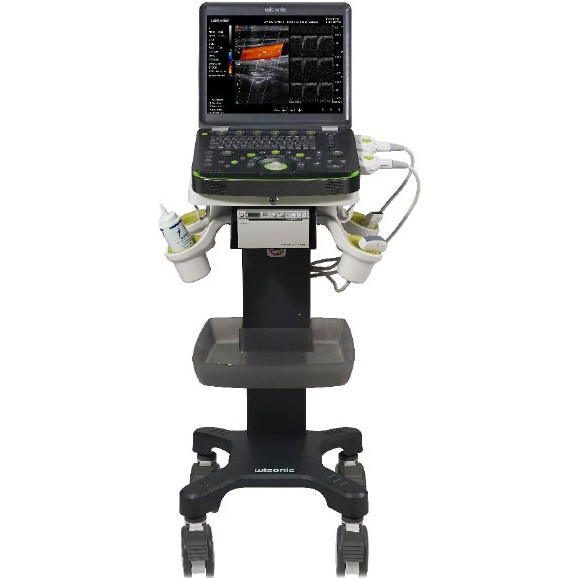 Портативна ультразвукова система експерт класу CLOVER 60 з ультразвуковим датчиком P4-1, фото 1