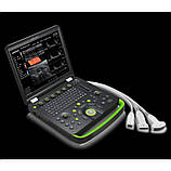 Портативна ультразвукова система експерт класу CLOVER 60 з ультразвуковим датчиком P4-1, фото 2