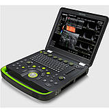 Портативна ультразвукова система експерт класу CLOVER 60 з ультразвуковим датчиком P4-1, фото 3