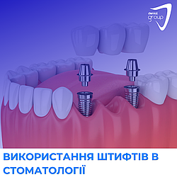 Використання штифтів в стоматології