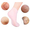 Силіконові гелеві зволожуючі шкарпетки Soft Gel Socks Rose, фото 4