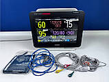 Монітор пацієнта модульний Philips IntelliVue MX450 modul X2 Set, фото 7