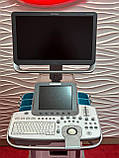УЗД апарат Siemens Acuson NX3, фото 5