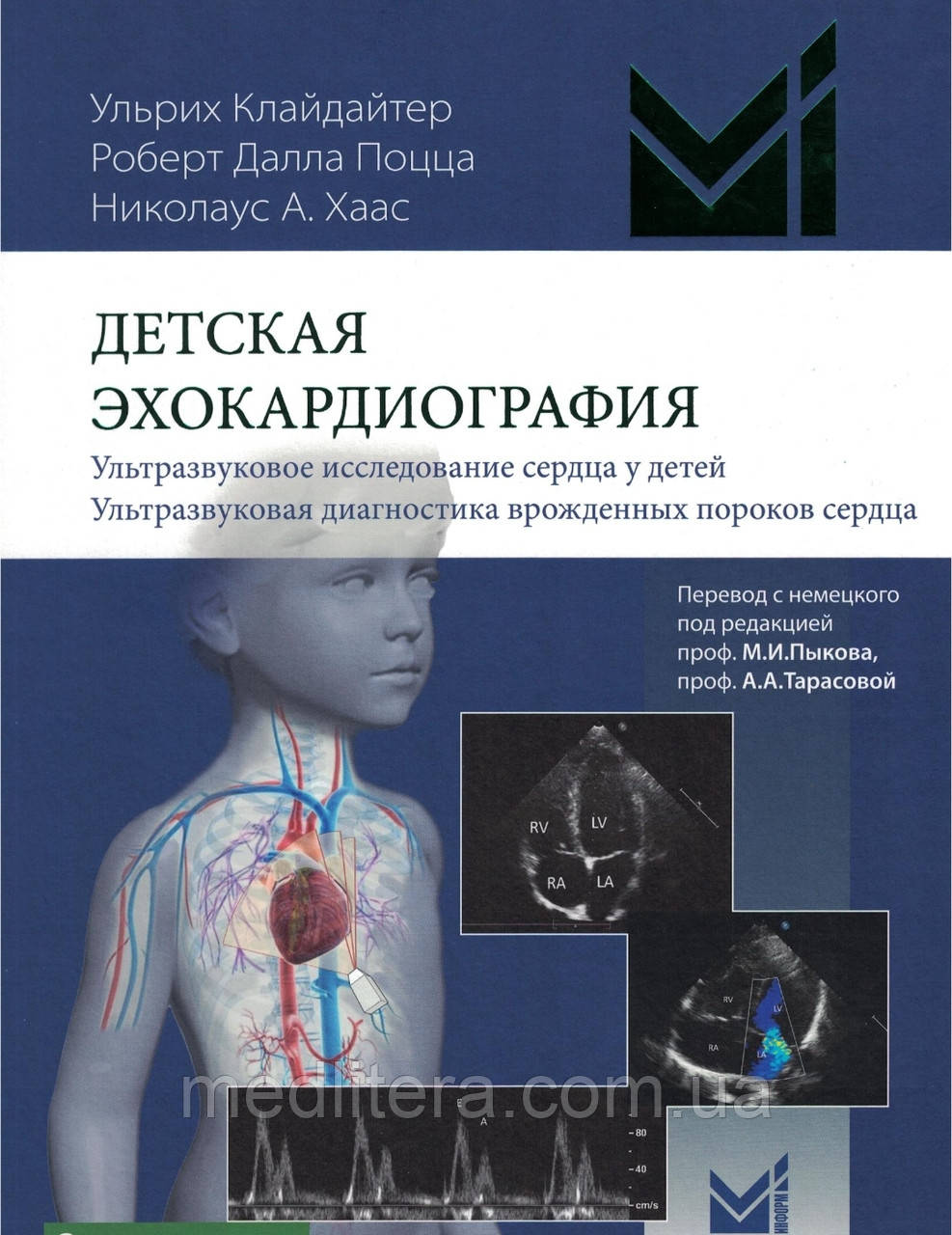 Дитяча ехокардіографія Клайдайтер / Дитяче ЕхО / Посібник по ЕХО 2022 рік