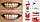 Паста Theramed Complete Plus100 мл Помпа, фото 6