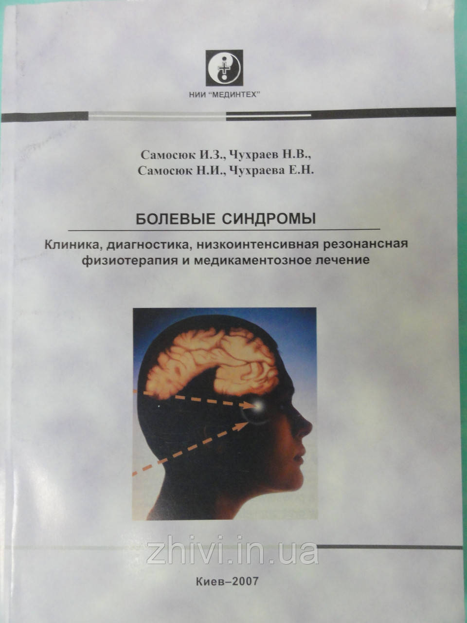 Больові синдроми