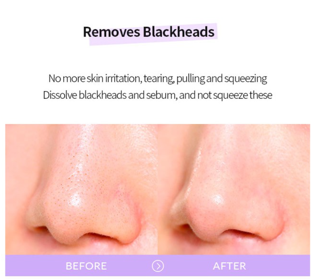 Гідрофільна олія від чорних цяток Celimax Derma Nature Fresh Blackhead Jojoba Cleansing Oil